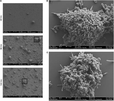 Mycoplasma genitalium Biofilms Contain Poly-GlcNAc and Contribute to Antibiotic Resistance